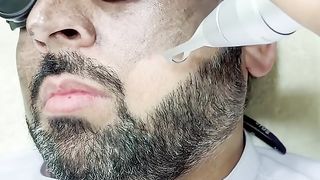 Carbon Peel #getsmarthairclub #laserhairtreatment #laser