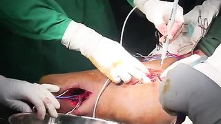 Surgery