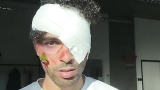 So to answer your question, it didn't hurt, but please don't try it at home..