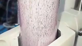 Dialyser Perticles