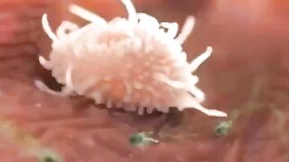 When you feel alone, remember that there are macrophages in your body actively chasing Escherichia coli bacteria ????