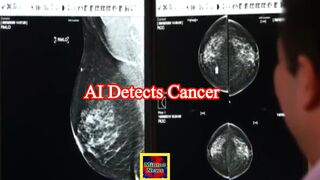 AI tool spots cancers missed by doctors