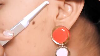 I ruined my face such beauty hack...