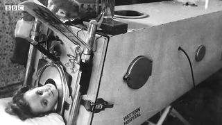 What is the iron lung and how does it work