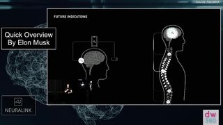 Elon Musk reveals Neuralink's new project that could restore sight - and says the 'implant is already working in monkeys'