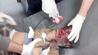 Situasi yang menyakitkan...