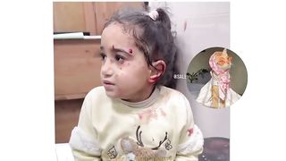 معناة اطفال غزة
