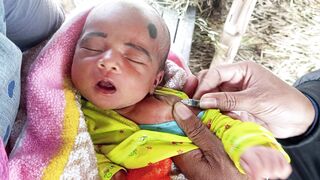 Newborn baby first time bcg vaccine