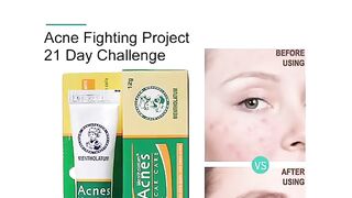 Acne scare