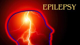 Methods of treating epilepsy