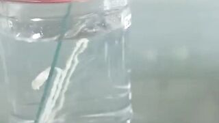 Tape worm and leach