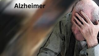 Alzheimer