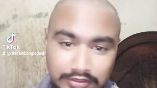 No hair