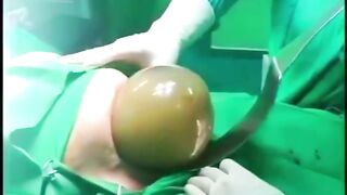 How beautiful the way a childbirth happens