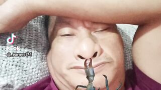 crab ???? bite