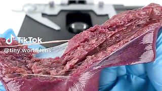 Microscope pork liver