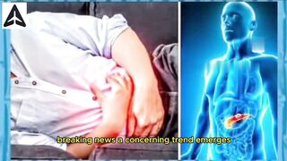 Colorectal Cancer: What You Need to Know