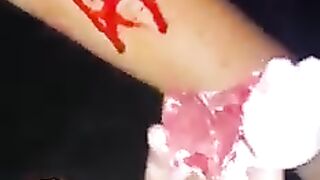 Eshq di bimari