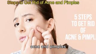 Steps to Get Rid of Acne and Pimples