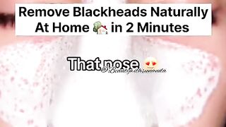 Remove Black heads