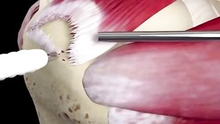 Start exploring a suite of 3D procedure videos in Complete Anatomy