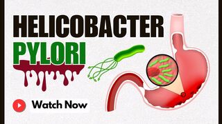 Helicobacter pylori: Pathogenesis, Transmission, its Effect on Stomach Health | Microbe Animated 101