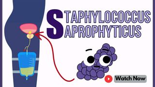 Staphylococcus Saprophyticus: An Overview | Microbiology 101 Crash Course
