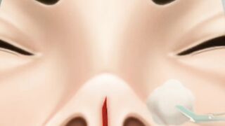 Amsr nose treatment