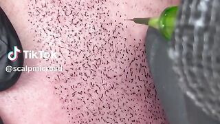 micro hair tattoo