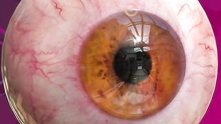 Human eye