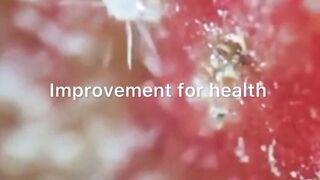 Health.