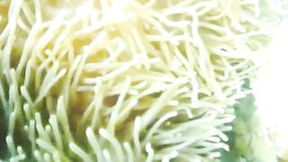 My video