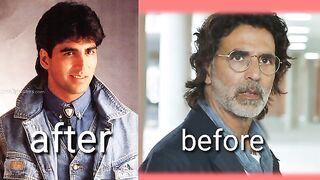 Akhshy Kumar after and before you image|for life