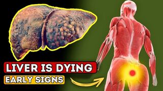 LIVER is DYING! 12 Weird Signs of Liver Damage | Healthify