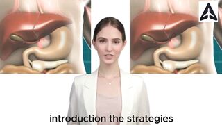 what is type 2 diabetes