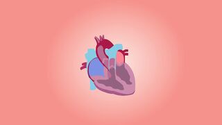 Brain ischemic stroke