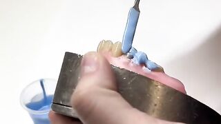 Flasking of complete denture
