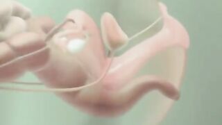 In Vitro Fertilization (IVF) Process 3D Animation