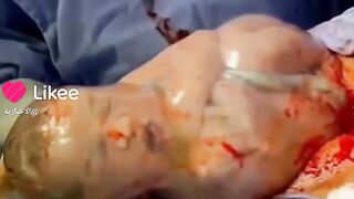 Naissance bebe