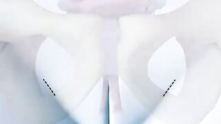 Tension Free Vaginal Tape Insertion 3D Animation (TVT)