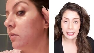 How to use retinol