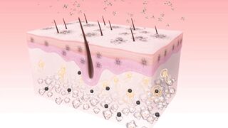 What are the causes of blackheads? #mix #blackheads
