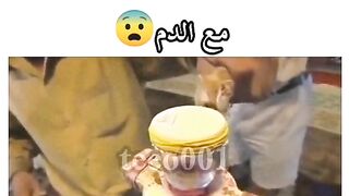 سم الافعى snake poison معلومة