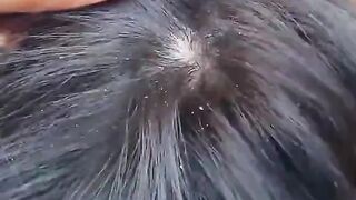 hair care