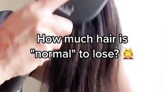 Hair loss solutions , Instagram @the._beautyland