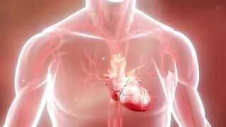 What Happens During Heart Attack? (3D Animation)