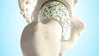 Total Hip Replacement ???? (Explained)