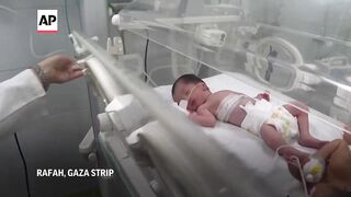Doctors save baby of a pregnant woman killed in Israeli airstrike on Rafah in Gaza.