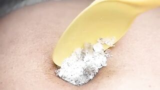 How does moxibustion work