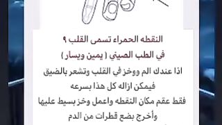جدا.. النقط في الجسم مهم الطب صيني
